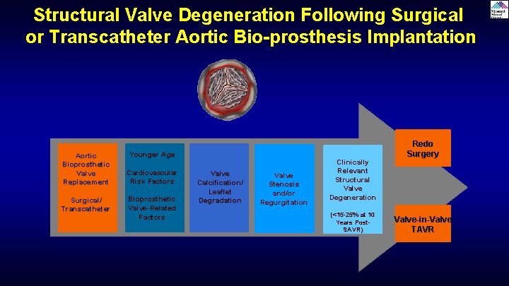 Structural Valve Degeneration Following Surgical or Transcatheter Aortic Bio-prosthesis Implantation Aortic Bioprosthetic Valve Replacement Structural Valve Degeneration Following Surgical or Transcatheter Aortic Bio-prosthesis Implantation Aortic Bioprosthetic Valve Replacement
