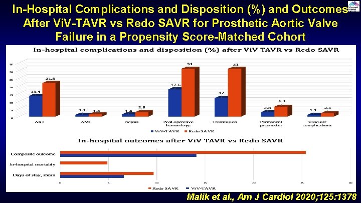 In-Hospital Complications and Disposition (%) and Outcomes After Vi. V-TAVR vs Redo SAVR for In-Hospital Complications and Disposition (%) and Outcomes After Vi. V-TAVR vs Redo SAVR for