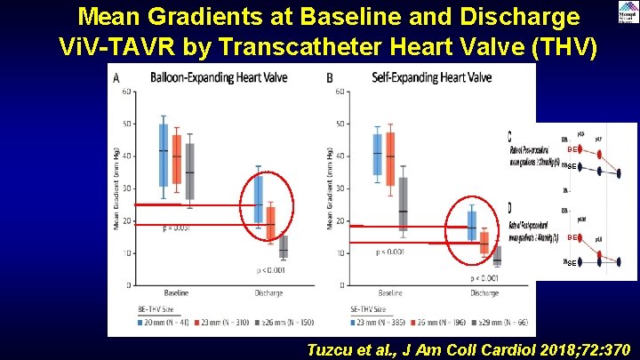 Mean Gradients at Baseline and Discharge Vi. V-TAVR by Transcatheter Heart Valve (THV) Type Mean Gradients at Baseline and Discharge Vi. V-TAVR by Transcatheter Heart Valve (THV) Type