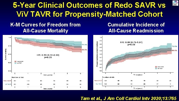 5 -Year Clinical Outcomes of Redo SAVR vs Vi. V TAVR for Propensity-Matched Cohort 5 -Year Clinical Outcomes of Redo SAVR vs Vi. V TAVR for Propensity-Matched Cohort