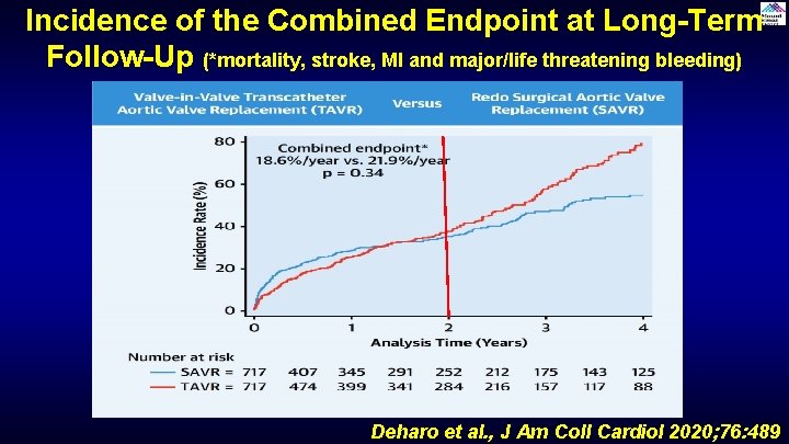 Incidence of the Combined Endpoint at Long-Term Follow-Up (*mortality, stroke, MI and major/life threatening Incidence of the Combined Endpoint at Long-Term Follow-Up (*mortality, stroke, MI and major/life threatening