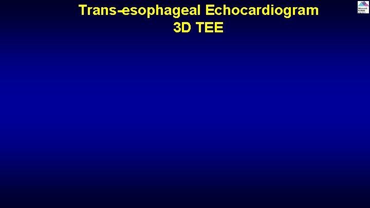 Trans-esophageal Echocardiogram 3 D TEE Trans-esophageal Echocardiogram 3 D TEE