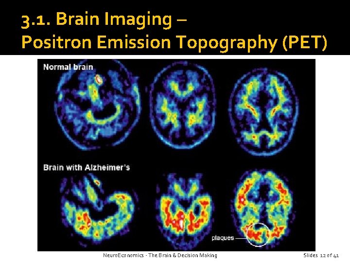 3. 1. Brain Imaging – Positron Emission Topography (PET) Neuro. Economics - The Brain