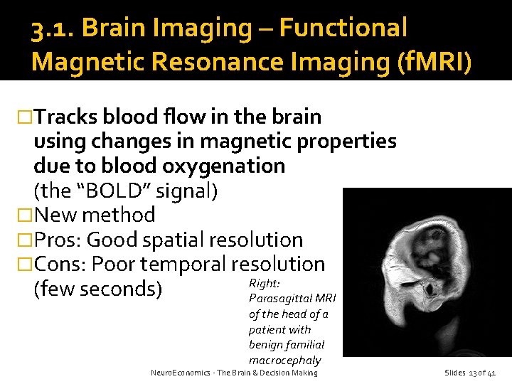 3. 1. Brain Imaging – Functional Magnetic Resonance Imaging (f. MRI) �Tracks blood flow