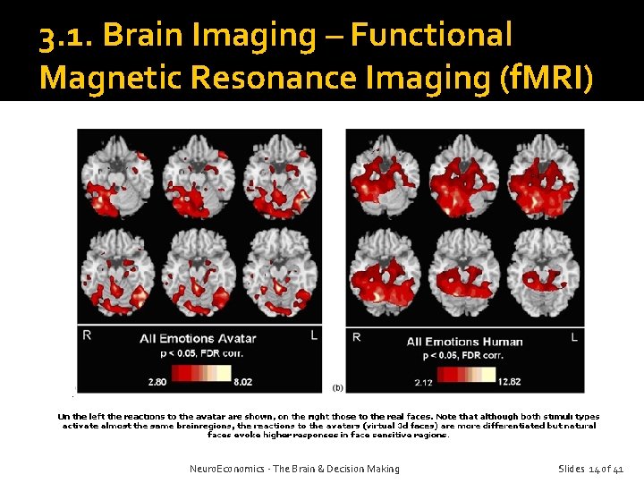 3. 1. Brain Imaging – Functional Magnetic Resonance Imaging (f. MRI) Neuro. Economics -