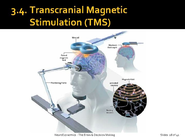 3. 4. Transcranial Magnetic Stimulation (TMS) Neuro. Economics - The Brain & Decision Making