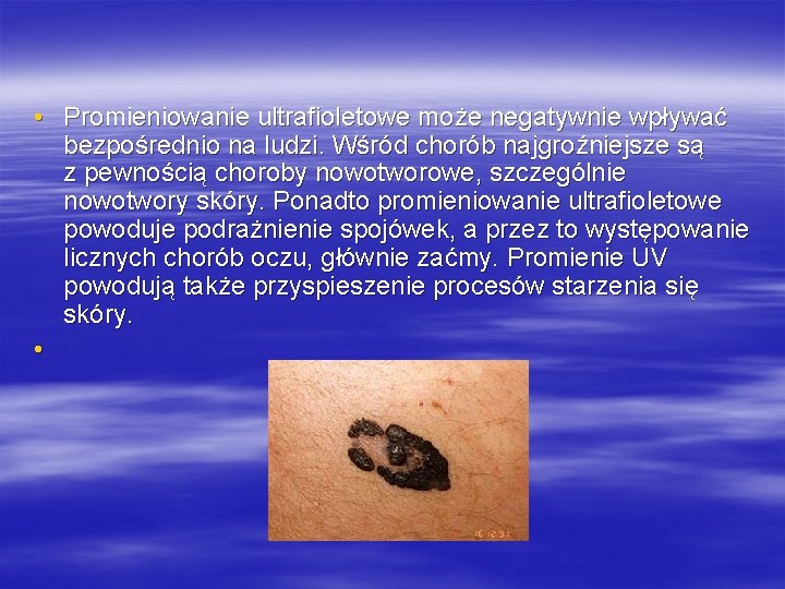 • Promieniowanie ultrafioletowe może negatywnie wpływać bezpośrednio na ludzi. Wśród chorób najgroźniejsze są • Promieniowanie ultrafioletowe może negatywnie wpływać bezpośrednio na ludzi. Wśród chorób najgroźniejsze są