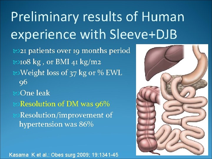Preliminary results of Human experience with Sleeve+DJB 21 patients over 19 months period 108