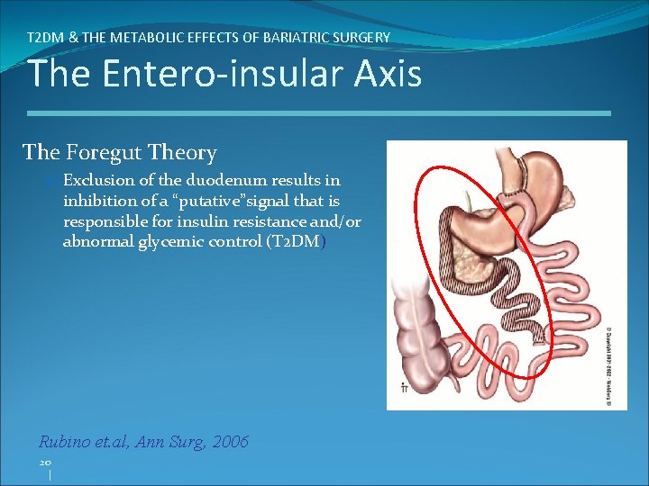 T 2 DM & THE METABOLIC EFFECTS OF BARIATRIC SURGERY The Entero-insular Axis The