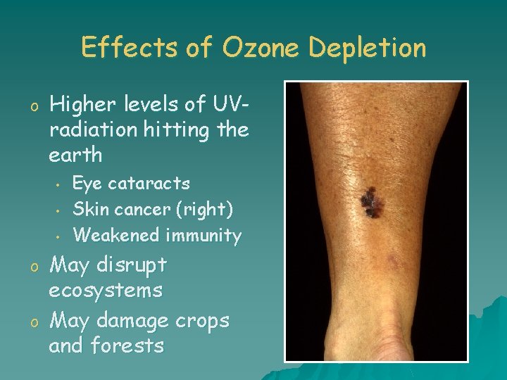 Effects of Ozone Depletion o Higher levels of UVradiation hitting the earth • •