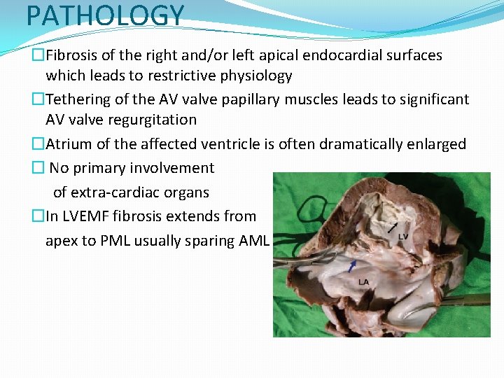 PATHOLOGY �Fibrosis of the right and/or left apical endocardial surfaces which leads to restrictive