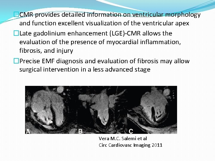 �CMR provides detailed information on ventricular morphology and function excellent visualization of the ventricular