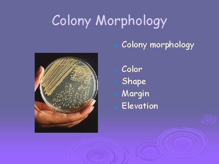 Colony Morphology Ø Colony morphology Color Ø Shape Ø Margin Ø Elevation Ø 