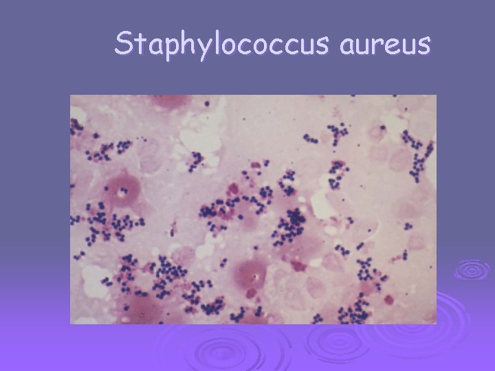 Staphylococcus aureus 
