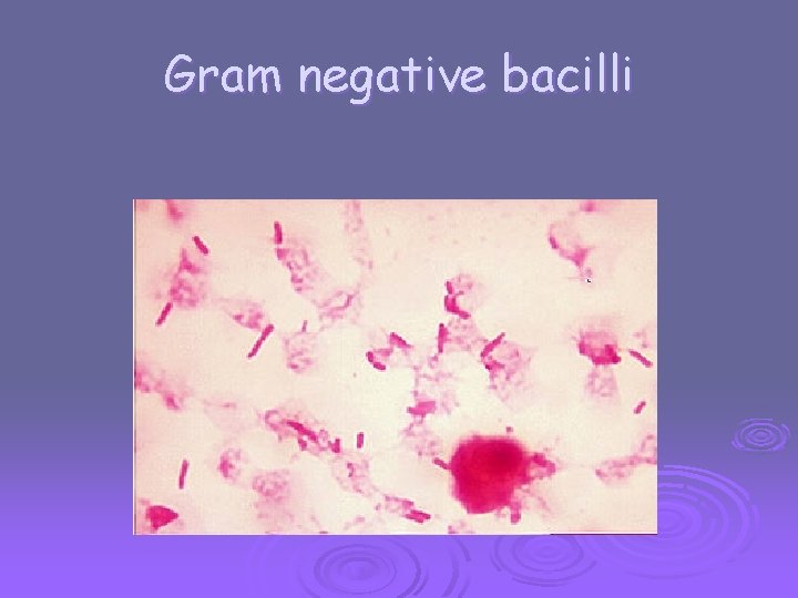 Gram negative bacilli 
