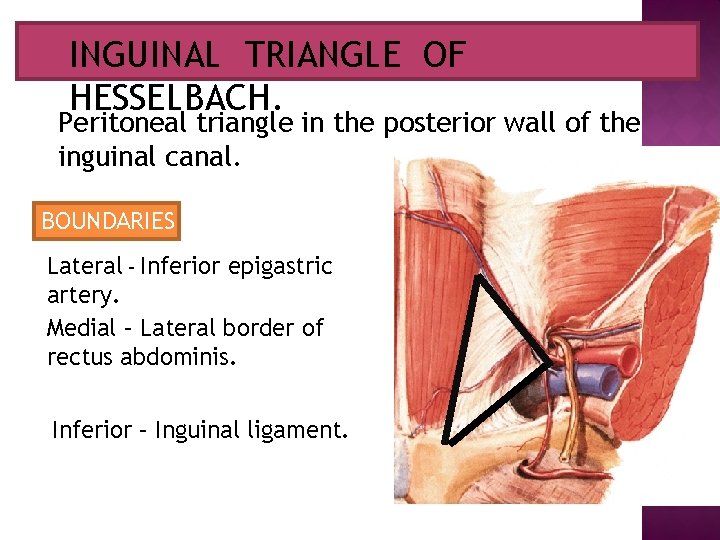 INGUINAL HESSELBACH. INGUINAL TRIANGLEOFOF HESSELBACH. Peritoneal triangle in the posterior wall of the inguinal