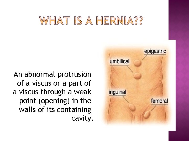 An abnormal protrusion of a viscus or a part of a viscus through a