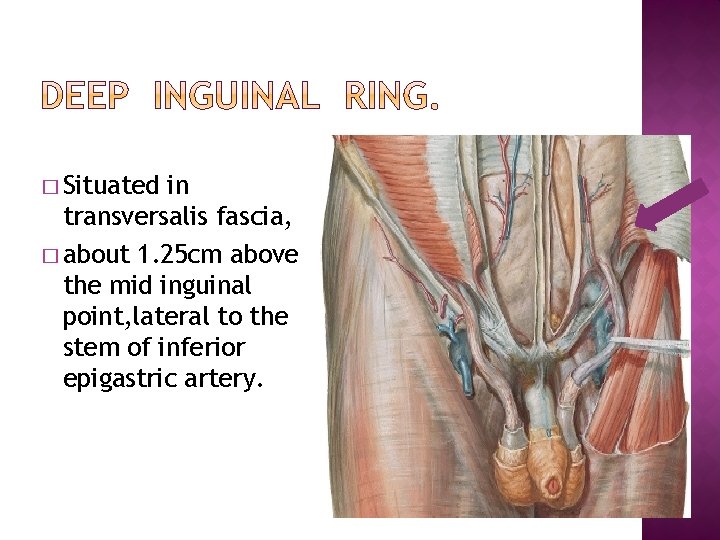 � Situated in transversalis fascia, � about 1. 25 cm above the mid inguinal