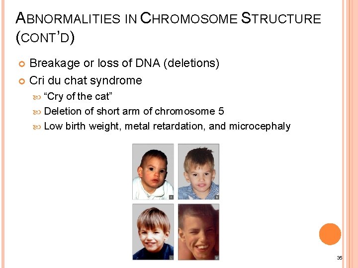 ABNORMALITIES IN CHROMOSOME STRUCTURE (CONT’D) Breakage or loss of DNA (deletions) Cri du chat