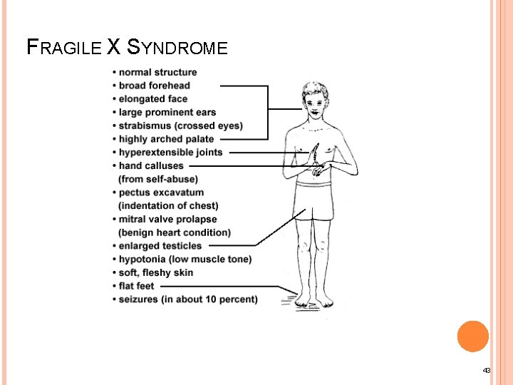 FRAGILE X SYNDROME 43 