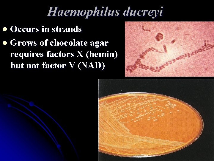 Haemophilus ducreyi Occurs in strands l Grows of chocolate agar requires factors X (hemin) Haemophilus ducreyi Occurs in strands l Grows of chocolate agar requires factors X (hemin)