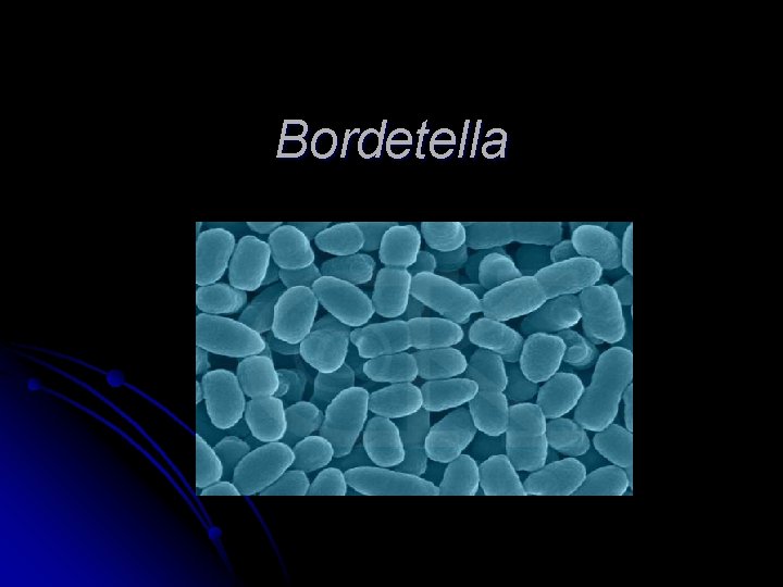 Bordetella Bordetella