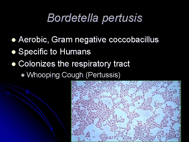 Bordetella pertusis Aerobic, Gram negative coccobacillus l Specific to Humans l Colonizes the respiratory Bordetella pertusis Aerobic, Gram negative coccobacillus l Specific to Humans l Colonizes the respiratory