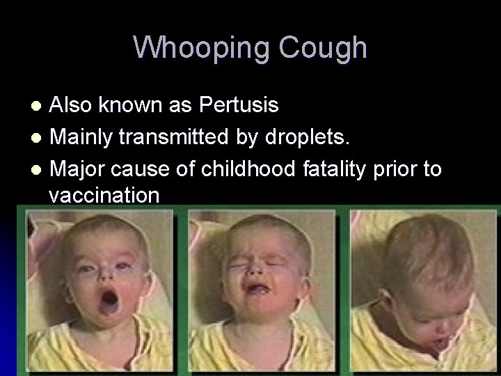 Whooping Cough Also known as Pertusis l Mainly transmitted by droplets. l Major cause Whooping Cough Also known as Pertusis l Mainly transmitted by droplets. l Major cause