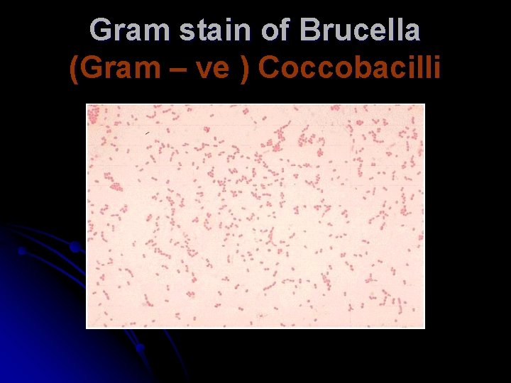 Gram stain of Brucella (Gram – ve ) Coccobacilli Gram stain of Brucella (Gram – ve ) Coccobacilli