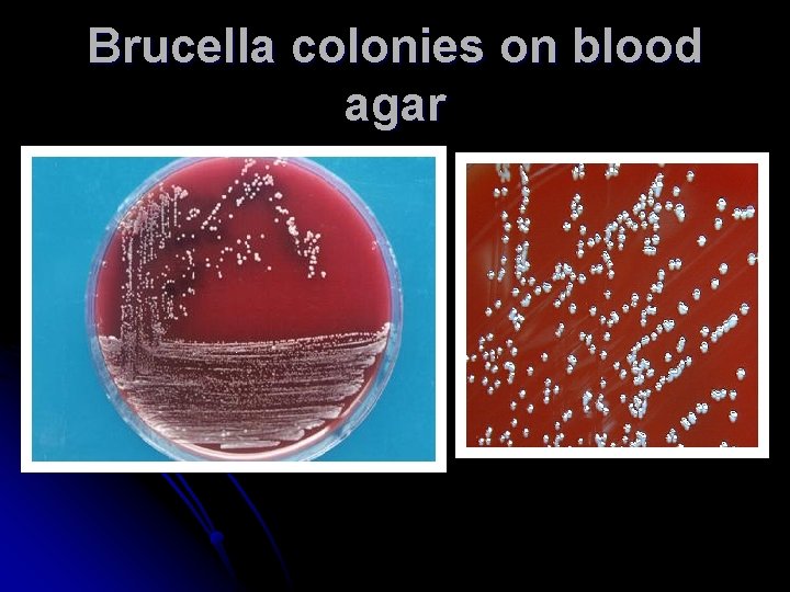 Brucella colonies on blood agar Brucella colonies on blood agar
