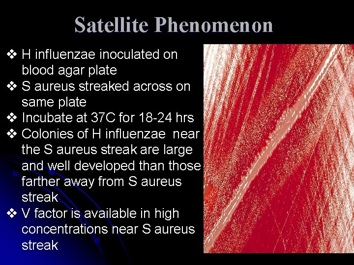 Satellite Phenomenon v H influenzae inoculated on blood agar plate v S aureus streaked Satellite Phenomenon v H influenzae inoculated on blood agar plate v S aureus streaked