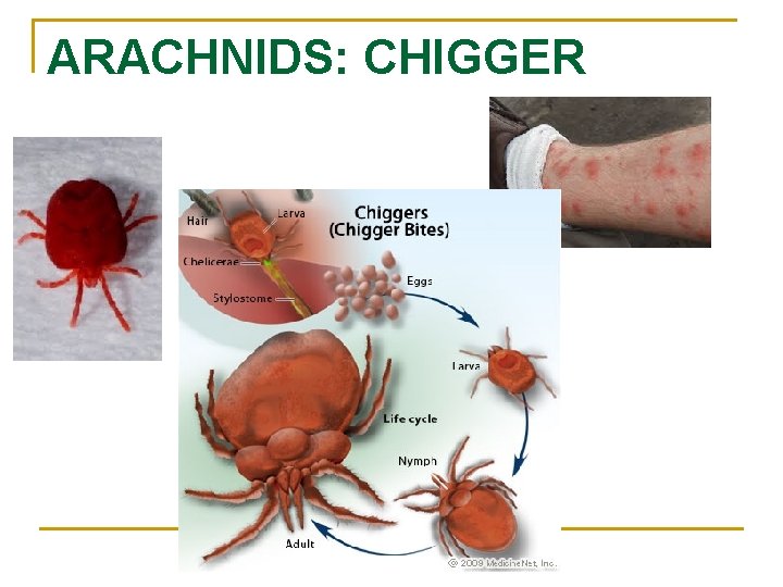 ARACHNIDS: CHIGGER n 