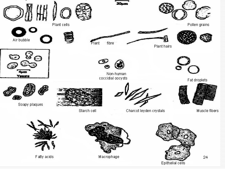 Pollen grains Plant cells Air bubble Plant fibre Plant hairs Non-human coccidial oocysts Fat