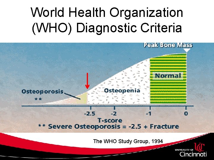 World Health Organization (WHO) Diagnostic Criteria The WHO Study Group, 1994 