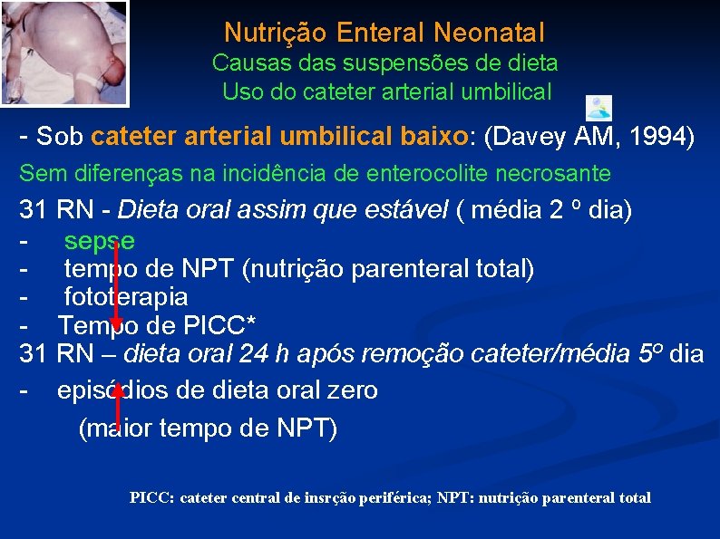 Nutrição Enteral Neonatal Causas das suspensões de dieta Uso do cateter arterial umbilical -