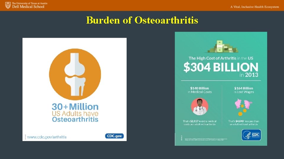 Burden of Osteoarthritis 