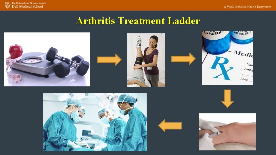 Arthritis Treatment Ladder 