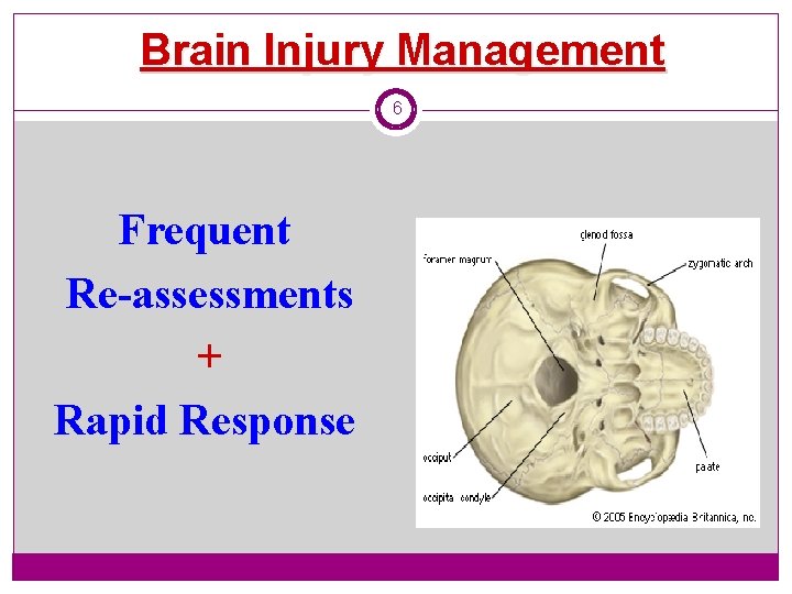 Brain Injury Management 6 Frequent Re-assessments + Rapid Response 