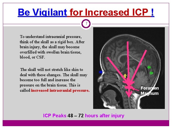 Be Vigilant for Increased ICP ! 7 To understand intracranial pressure, think of the