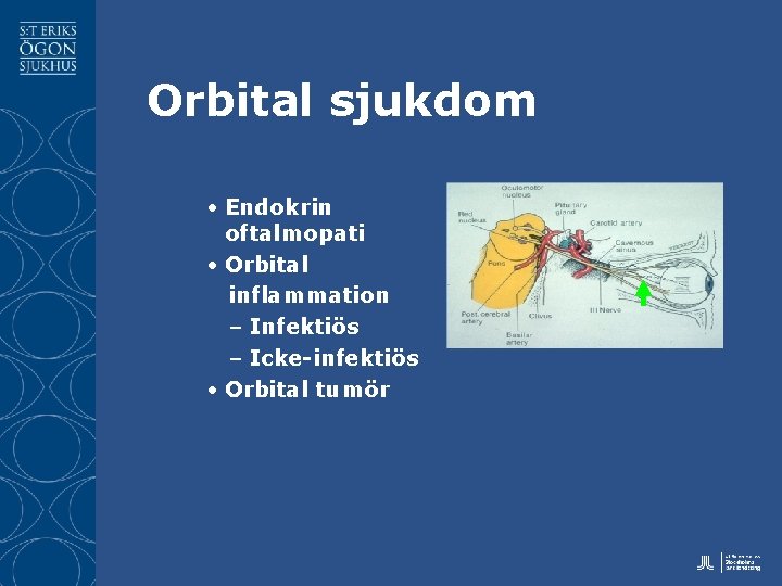 Orbital sjukdom • Endokrin oftalmopati • Orbital inflammation – Infektiös – Icke-infektiös • Orbital