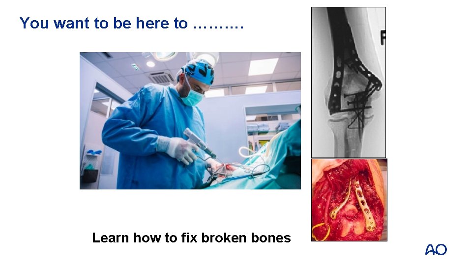 You want to be here to ………. Learn how to fix broken bones 