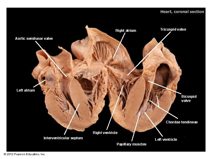 Right atrium Tricuspid valve Aortic semilunar valve Left atrium Bicuspid valve Chordae tendineae Right