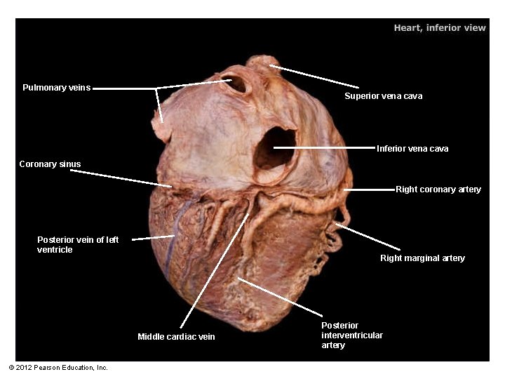 Pulmonary veins Superior vena cava Inferior vena cava Coronary sinus Right coronary artery Posterior