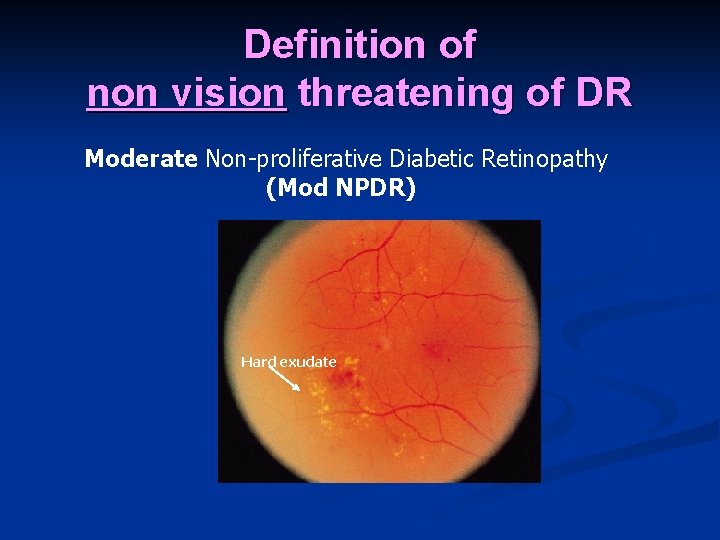 Definition of non vision threatening of DR Moderate Non-proliferative Diabetic Retinopathy (Mod NPDR) Hard