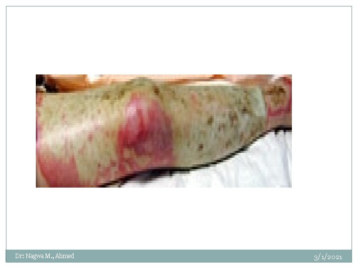 Dr: Nagwa M. , Ahmed 3/1/2021 