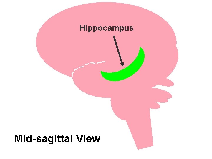 Hippocampus Mid-sagittal View 