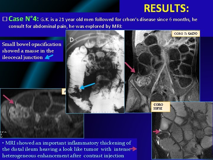 RESULTS: � Case N° 4: G. K. is a 21 year old men followed