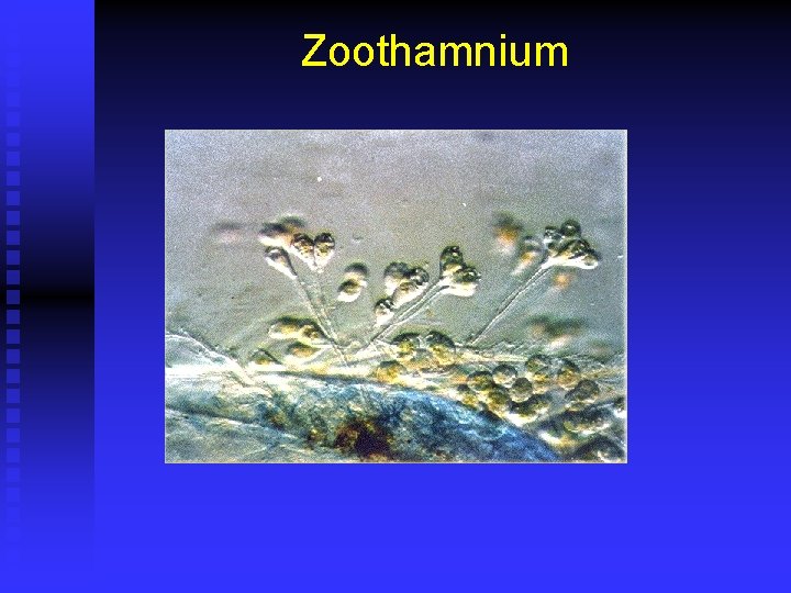 Zoothamnium 