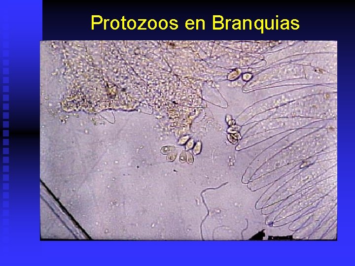 Protozoos en Branquias 