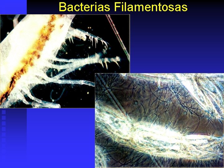 Bacterias Filamentosas 